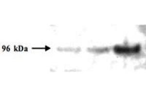 Western blot analysis is shown using PMS2 monoclonal antibody, clone 1214  to detect human PMS2 protein present in H157 cell lysates.