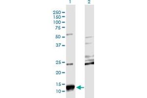 Western Blot analysis of SCGB2A2 expression in transfected 293T cell line by SCGB2A2 monoclonal antibody (M08), clone 3A4. (Mammaglobin A 抗体  (AA 1-93))