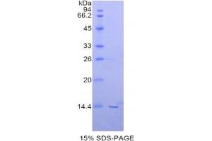SDS-PAGE analysis of Human PIN4 Protein. (PIN4 蛋白)