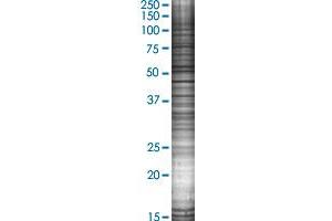 RAD51C transfected lysate. (RAD51C 293T Cell Transient Overexpression Lysate(Denatured))