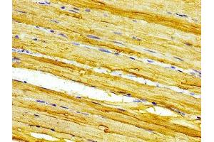 Immunohistochemistry of paraffin-embedded human skeletal muscle tissue using ABIN7146585 at dilution of 1:100 (CASQ2 抗体  (AA 219-300))