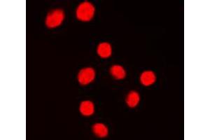 Immunofluorescent analysis of KLF1/5/7 staining in Jurkat cells. (KLF1/5/7 抗体  (C-Term))