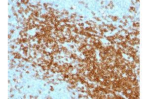 Formalin-fixed, paraffin-embedded human Tonsil stained with CD43 Mouse Monoclonal Antibody (SPN/1094). (CD43 抗体)