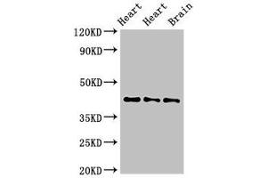 Western Blot Positive WB detected in: Rat heart tissue, Mouse heart tissue, Mouse brain tissue All lanes: NPSR1 antibody at 4 μg/mL Secondary Goat polyclonal to rabbit IgG at 1/50000 dilution Predicted band size: 43, 36, 45, 44, 42, 19, 16, 17, 11 kDa Observed band size: 43 kDa (NPSR1 抗体  (AA 1-52))