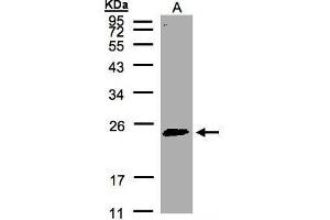 WB Image Sample(30 μg of whole cell lysate) A:HeLa S3, 12% SDS PAGE antibody diluted at 1:500 (RAB2A 抗体  (C-Term))