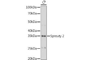 SPRY2 抗体
