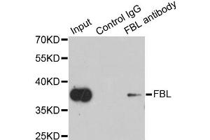 Immunoprecipitation analysis of 200ug extracts of HeLa cells using 1ug FBL antibody. (Fibrillarin 抗体)