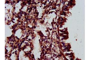Immunohistochemistry (IHC) image for anti-ELMO/CED-12 Domain Containing 3 (ELMOD3) (AA 1-102) antibody (ABIN7151530)