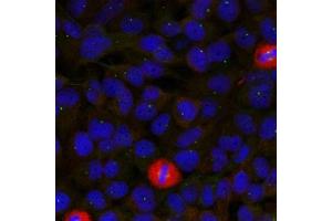 Immunofluorescence staining of methanol-fixed Hela cells using eIF4G(Ab-1232) Antibody. (EIF4G1 抗体)