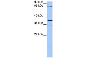 WB Suggested Anti-NLGN4X Antibody Titration:  0. (Neuroligin 4 抗体  (N-Term))