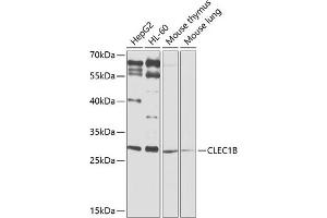 Western blot analysis of extracts of various cell lines, using CLEC1B antibody (ABIN6130012, ABIN6138705, ABIN6138706 and ABIN6225314) at 1:1000 dilution. (C-Type Lectin Domain Family 1, Member B (CLEC1B) (AA 22-196) 抗体)