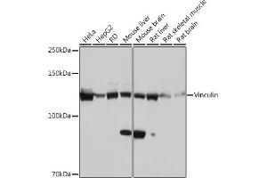 Western blot analysis of extracts of various cell lines, using Vinculin Rabbit mAb (ABIN3016604, ABIN3016605, ABIN1680530 and ABIN1680531) at 1:1000 dilution. (Vinculin 抗体)