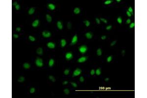 Image no. 4 for anti-CAMP Responsive Element Binding Protein 5 (CREB5) (AA 1-100) antibody (ABIN599087) (CREB5 抗体  (AA 1-100))