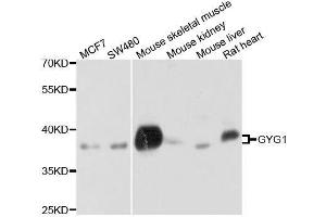 Western blot analysis of extracts of various cell lines, using GYG1 antibody. (Glycogenin 1 抗体  (AA 234-333))