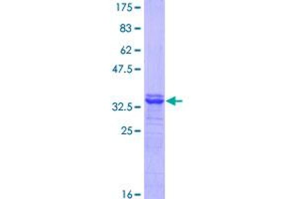 SLC7A1 Protein (AA 431-492) (GST tag)