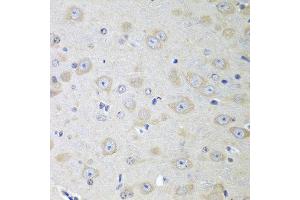 Immunohistochemistry of paraffin-embedded mouse brain using YES1 antibody at dilution of 1:100 (40x lens). (YES1 抗体)