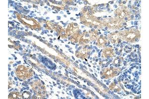 RPUSD2 antibody was used for immunohistochemistry at a concentration of 4-8 ug/ml to stain Epithelial cells of renal tubule (arrows) in Human Kidney. (RPUSD2 抗体  (N-Term))