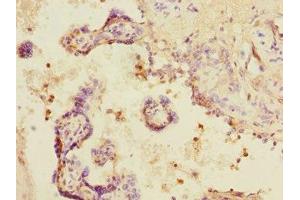 Immunohistochemistry of paraffin-embedded human placenta tissue using ABIN7160270 at dilution of 1:100 (DCP1A 抗体  (AA 303-582))