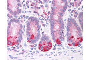 LRRC59 antibody was used for immunohistochemistry at a concentration of 4-8 ug/ml. (LRRC59 抗体  (N-Term))