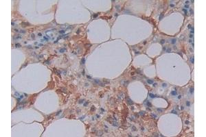 Immunohistochemistry (IHC) image for anti-Ferritin, Light Polypeptide (FTL) (AA 2-175) antibody (ABIN7435310)