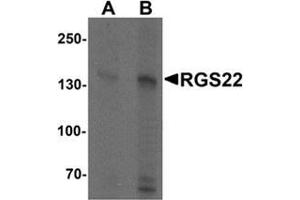 Western blot analysis of RGS22 in Jurkat cell lysate with RGS22 Antibody  at (A) 1 and (B) 2 μg/ml. (RGS22 抗体  (N-Term))
