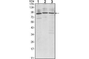 Western blot analysis using IGF2BP3 mouse mAb against Jurkat (1), K562 (2) and NTERA-2 (3) cell lysate. (IGF2BP3 抗体)