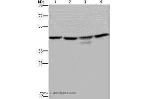 Western blot analysis of K562 and 293T cell, Jurkat cell and mouse brain tissue, using CSNK2A1 Polyclonal Antibody at dilution of 1:300 (CSNK2A1/CK II alpha 抗体)