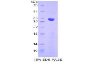 SDS-PAGE analysis of Mouse Numb Homolog Protein. (NUMB 蛋白)