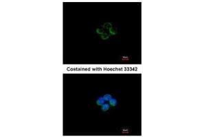 ICC/IF Image Immunofluorescence analysis of methanol-fixed A431, using ACADM, antibody at 1:200 dilution. (Medium-Chain Specific Acyl-CoA Dehydrogenase, Mitochondrial (MCAD) (Center) 抗体)