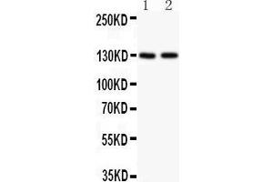 Anti-Hamartin Picoband antibody,  All lanes: Anti Hamartin  at 0. (TSC1 抗体  (AA 686-884))