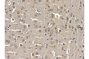 ABIN6259329 and ABIN6275330 at 1/100 staining rat brain tissue by IHC-P. (NOL10 抗体  (C-Term))
