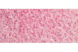 Detection of PK in Human Liver Tissue using Polyclonal Antibody to Prekallikrein (PK)