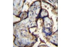 Immunohistochemistry (Paraffin-embedded Sections) (IHC (p)) image for anti-Integrin, alpha 5 (ITGA5) (AA 574-602), (Middle Region) antibody (ABIN951340)