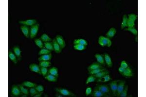 Immunofluorescent analysis of HepG2 cells using ABIN7157681 at dilution of 1:100 and Alexa Fluor 488-congugated AffiniPure Goat Anti-Rabbit IgG(H+L) (KNG1 抗体  (AA 390-644))