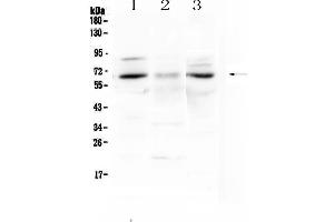 Western blot analysis of CCKBR using anti-CCKBR antibody . (CCKBR 抗体)