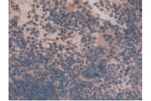 IHC-P analysis of Mouse Spleen Tissue, with DAB staining. (GLUD1 抗体  (AA 65-273))