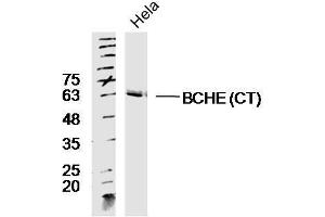 Lane 1: HeLa lysates probed with Rabbit Anti-BCHE Polyclonal Antibody, Unconjugated  at 1:300 overnight at 4˚C. (Butyrylcholinesterase 抗体  (AA 505-602))