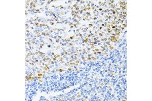 Immunohistochemistry (IHC) image for anti-DNA (Cytosine-5)-Methyltransferase 1 (DNMT1) (AA 1-270) antibody (ABIN7266810)