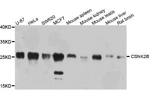 Western blot analysis of extracts of various cell lines, using CSNK2B antibody. (CSNK2B 抗体)