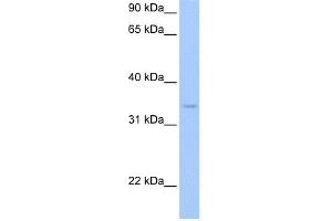 WB Suggested Anti-PDXK Antibody Titration: 0. (PDXK 抗体  (N-Term))