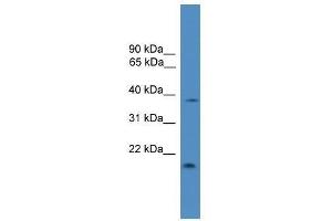 TIMP3 antibody used at 0. (TIMP3 抗体  (Middle Region))