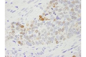 Immunohistochemistry (IHC) image for anti-Importin Subunit alpha-1 (KPNA2) (C-Term) antibody (ABIN7448767) (Importin Subunit alpha-1 (KPNA2) (C-Term) 抗体)
