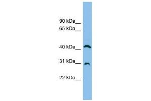 ADA antibody used at 1 ug/ml to detect target protein. (ADA 抗体  (N-Term))