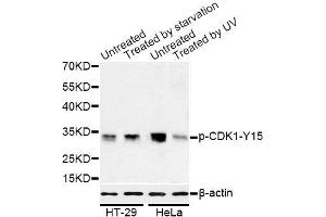 Western blot analysis of extracts of HT-29 and HeLa cells, using Phospho-CDK1-Y15 antibody (ABIN5969877) at 1/1000 dilution. (CDK1 抗体  (pTyr15))