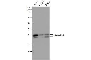 WB Image Caveolin 1 antibody detects Caveolin 1 protein by western blot analysis. (Caveolin-1 抗体  (N-Term))