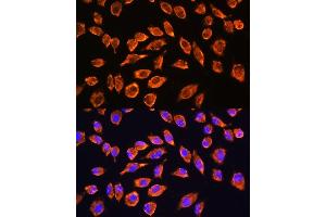 Immunofluorescence (IF) image for anti-Glutamate Receptor, Ionotropic, N-Methyl D-Aspartate 2a (GRIN2A) (AA 1130-1400) antibody (ABIN1681064)