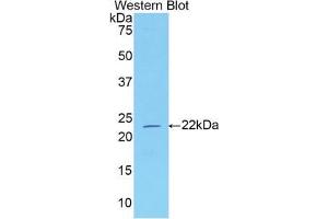 Western blot analysis of the recombinant protein. (Neuropilin 1 抗体  (AA 645-821))