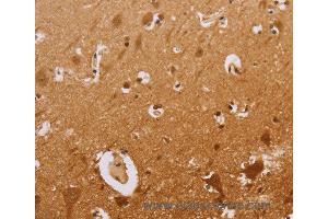 Immunohistochemistry of Human brain  using CEL Polyclonal Antibody at dilution of 1:50 (Cholesterol Esterase 抗体)