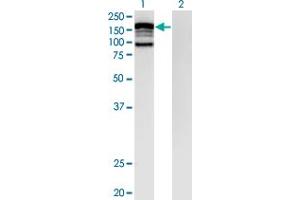 Western Blot analysis of CLIP2 expression in transfected 293T cell line by CLIP2 monoclonal antibody (M07), clone 3H5. (CLIP2 抗体  (AA 946-1046))