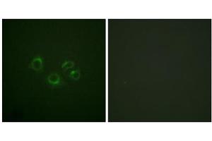 Immunofluorescence analysis of A549 cells, using EPHA2/3/4 (epitope around residue 588/596) antibody. (EPHA2/3/4 抗体  (Tyr588, Tyr596))